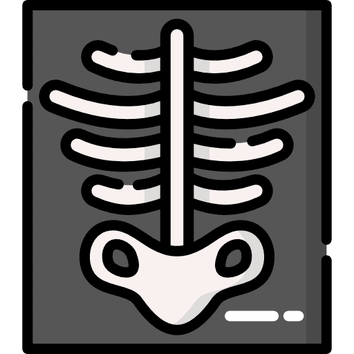An X-ray scan of a ribcage, representing radiology and medical imaging