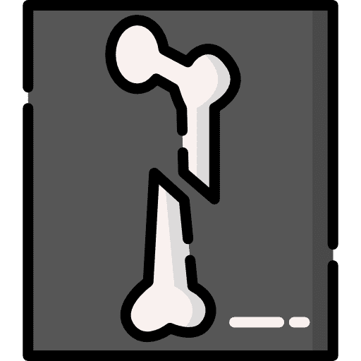 An X-ray scan of a limb, representing radiology and medical imaging